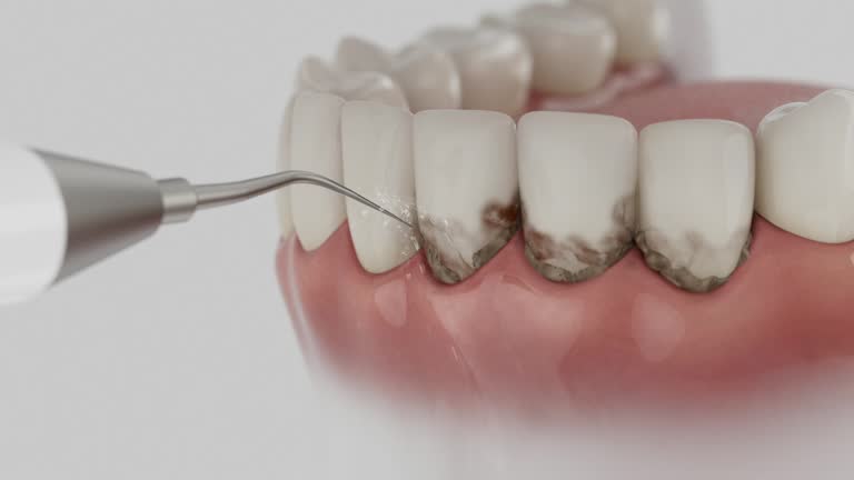 Trusted Emergency Dentist service in Charlestown, MD - Dentist Open Now